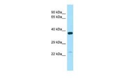 TXNL6 Rabbit anti-Human, Polyclonal, Novus Biologicals 100 &mu;g | Buy Online | Novus Biologicals | Fisher Scientific